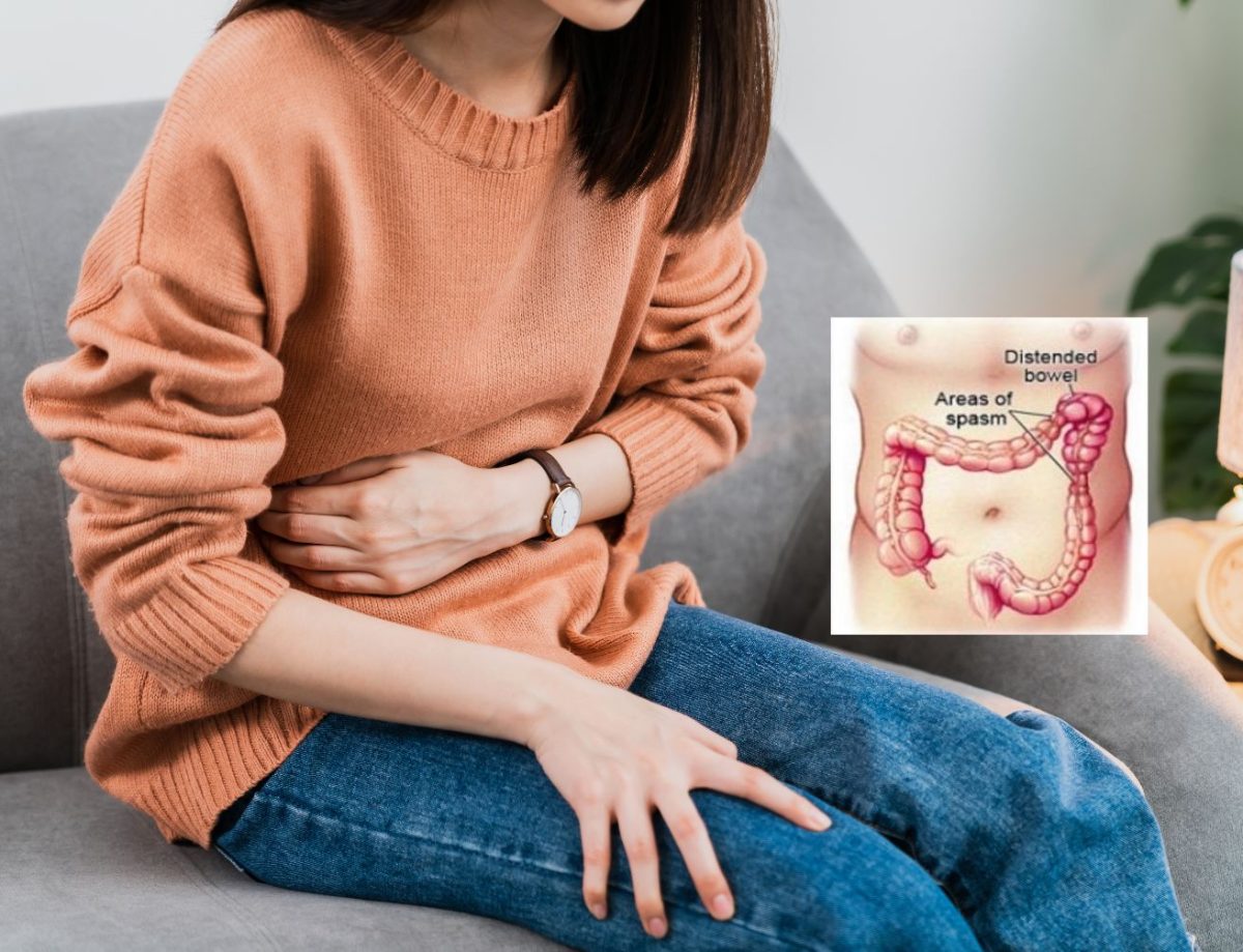 irritable-bowel-syndrome-australian-colon-health